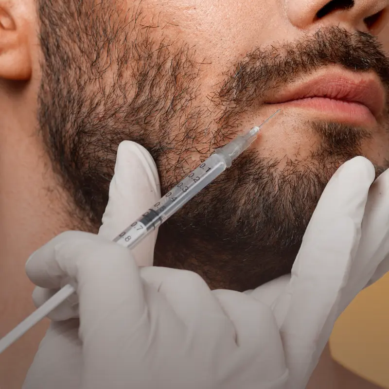 O Ácido Hialurónico no Homem hidrata a pele, suaviza linhas de expressão e devolve definição natural. Descubra a solução ideal para o Homem.