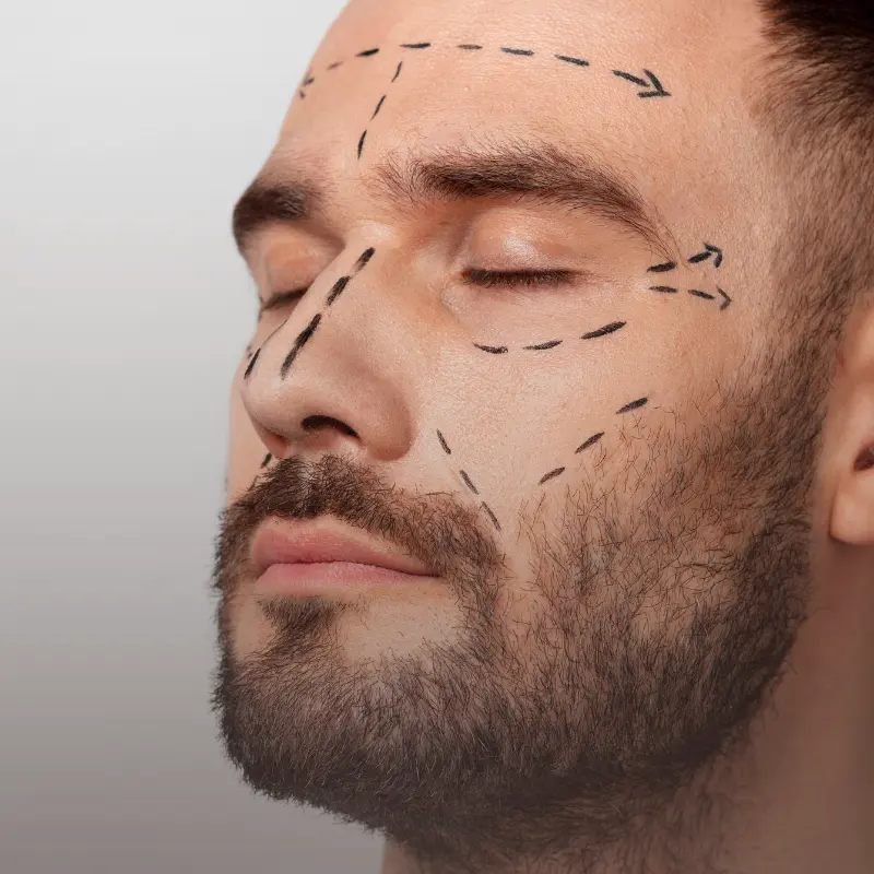 O Ácido Hialurónico no Homem hidrata a pele, suaviza linhas de expressão e devolve definição natural. Descubra a solução ideal para o Homem.