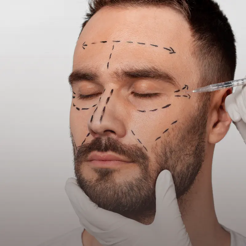 O Ácido Hialurónico no Homem hidrata a pele, suaviza linhas de expressão e devolve definição natural. Descubra a solução ideal para o Homem.