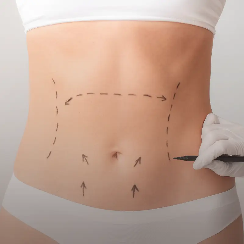 A cirurgia estética pode ser uma ferramenta poderosa para melhorar o bem-estar e a qualidade de vida