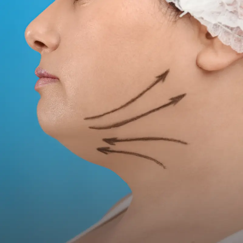 A cirurgia estética pode ser uma ferramenta poderosa para melhorar o bem-estar e a qualidade de vida