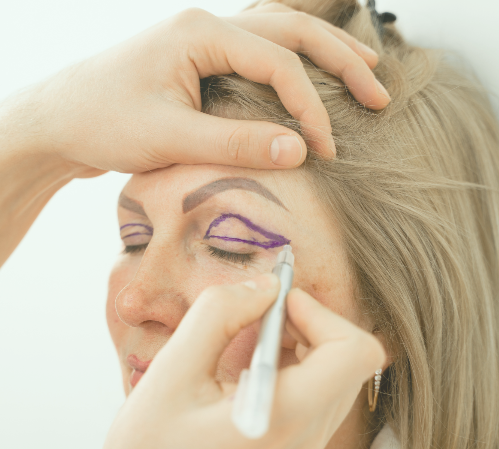 blefaroplastia